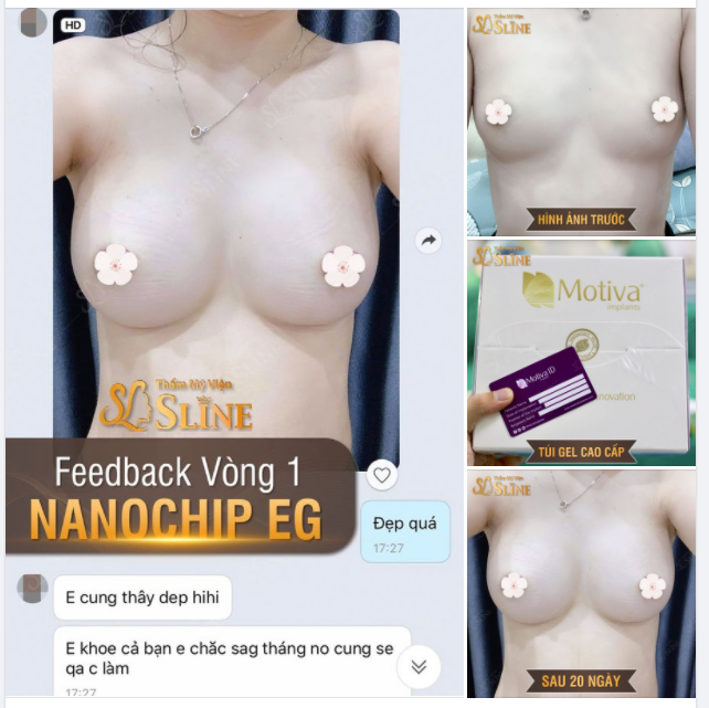 FEEDBACK THỰC TẾ  Khách hàng đặt túi Nanochip Ergonomix sau 20 ngày.