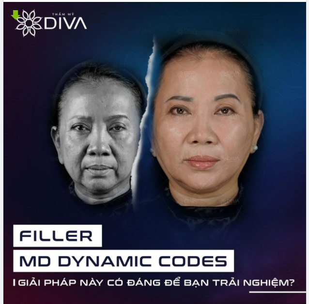 FILLER MD DYNAMIC CODES: GIẢI PHÁP TRẺ HÓA TOÀN DIỆN XỨNG ĐÁNG ĐỂ TRẢI NGHIỆM