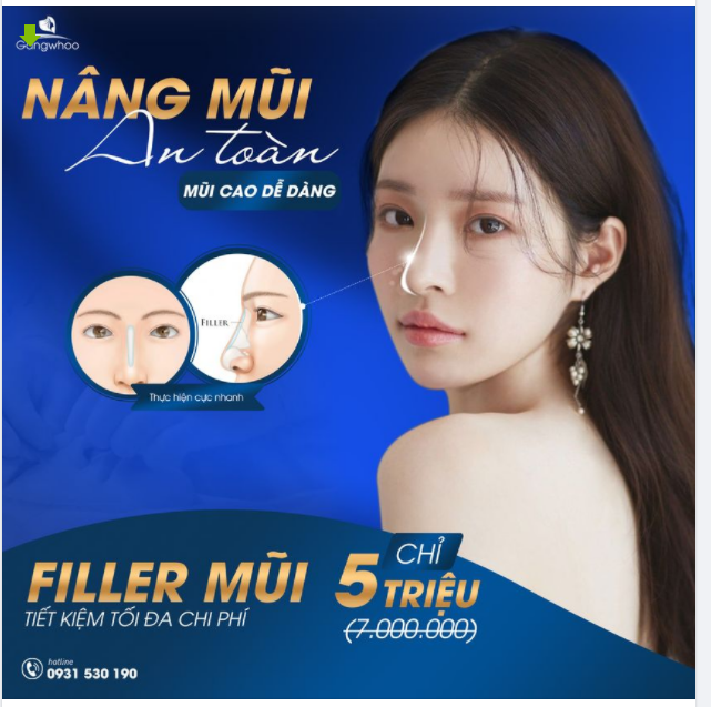 FILLER – TẠO HÌNH DÁNG MŨI KHÔNG PHẪU THUẬT