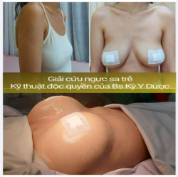 GIẢI CỨU NGỰC SA TRỄ THÀNH CÔNG - NGOẠN MỤC TẠI BS KỲ Y DƯỢC