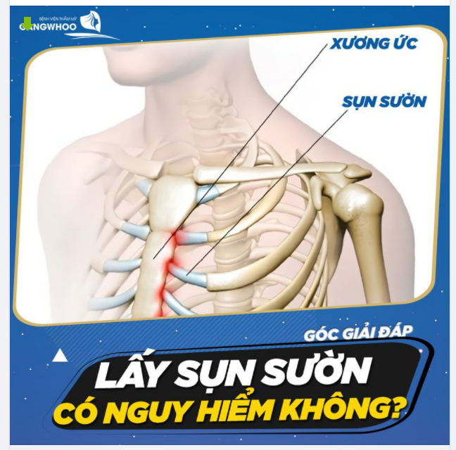 GIẢI ĐÁP THẮC MẮC: LẤY (SỤN SƯỜN) CÓ NGUY HIỂM KHÔNG?