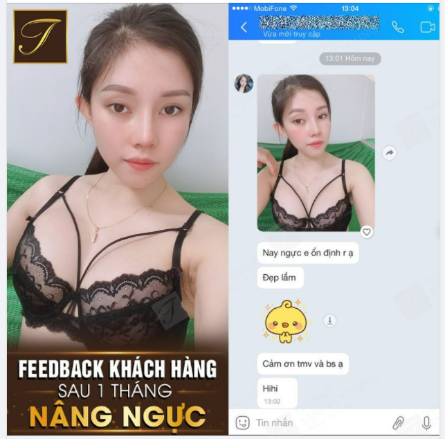 GIẢI PHÁP CHO NHỮNG CÔ NÀNG NGỰC LÉP