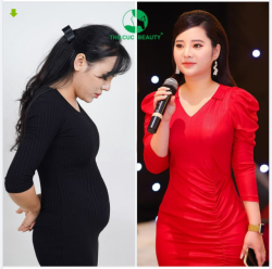 GIẢM MỠ GỌN GÀNG - ĐỊNH HÌNH FORM DÁNG