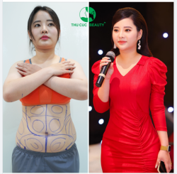 GIẢM MỠ GỌN GÀNG - ĐỊNH HÌNH FORM DÁNG
