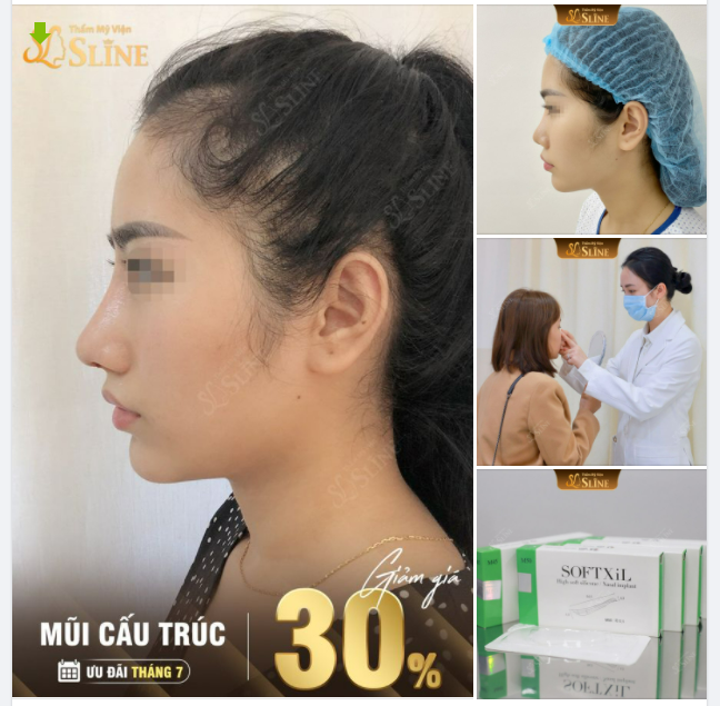 GIẢM NGAY 30% ..khi nâng mũi cấu trúc trong tháng này.