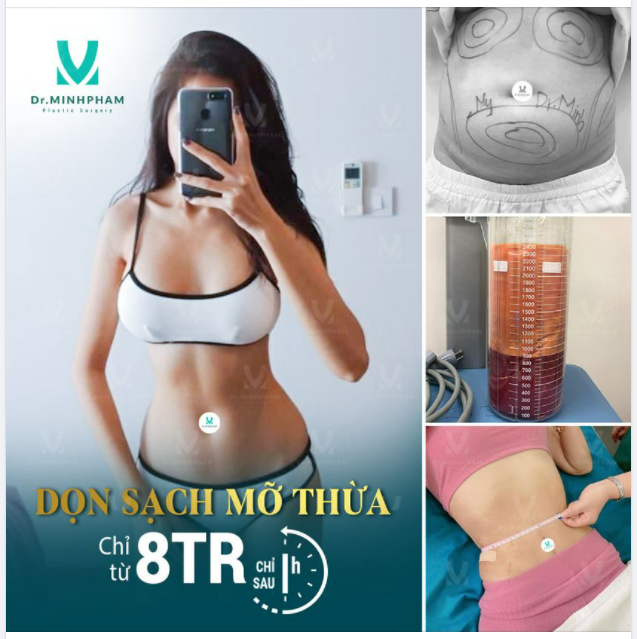 GIẢM SIZE MỠ - ĐỠ SIZE QUẦN HÚT MỠ BIO NANO CHỈ TỪ 8TR/VÙNG