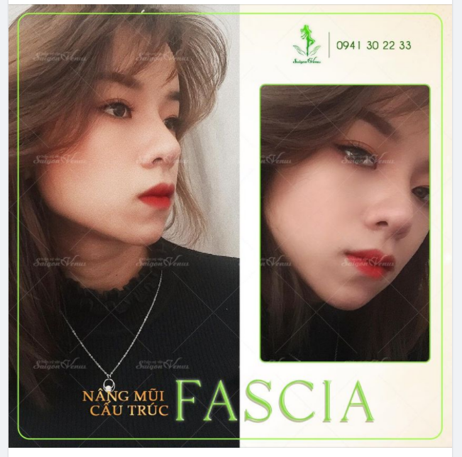 GÓC NGHIÊNG TỶ LỆ VÀNG - NHẬN THÊM NGÀN ƯU ĐÃI