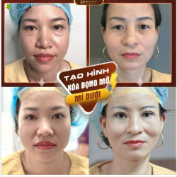 Gửi trao đôi mắt cho Dr.Hải Lê - Lãi lắm bạn có thể nhận lại 5-10 năm tuổi xuân