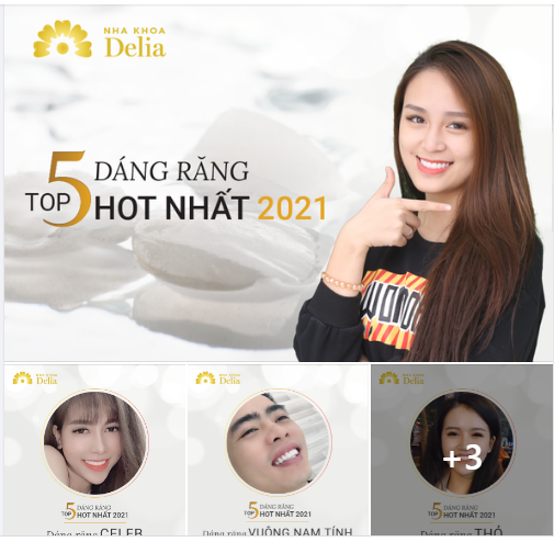 GƯƠNG MẶT CỦA BẠN PHÙ HỢP VỚI DÁNG RĂNG NÀO