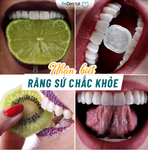Hàm răng chắc khỏe đảm bảo được 3 yếu tố: Trắng sáng - Cứng chắc - Không có mùi hơi thở