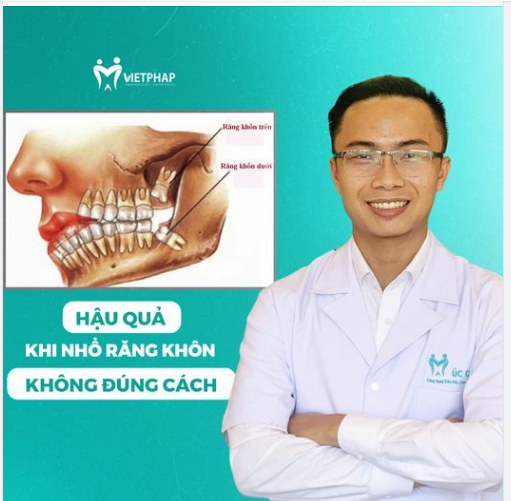 HẬU QUẢ CỦA VIỆC NHỔ RĂNG KHÔN SAI CÁCH