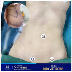 HÈ ĐẾN RỒI - HÚT MỠ THÔI