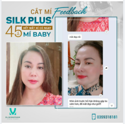 HẾT 1 MÍ – XINH HẾT Ý FEEDBACK: KH CẮT MÍ SILK PLUS