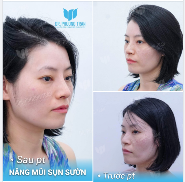 HẾT GỒ ĐỂ ĐẸP VÀ TỐT TƯỚNG SỐ, TẠI SAO KHÔNG?