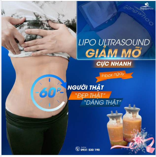 HẾT SẠCH MỠ THỪA – CHÀO ĐÓN EO THON