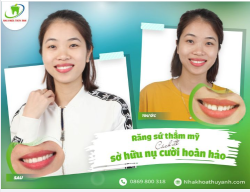 HẾT THƯA CHỈ SAU MỘT LẦN THỰC HIỆN