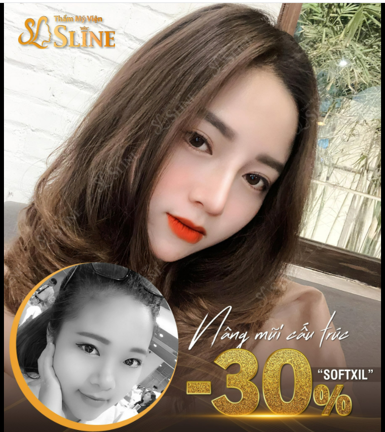 Hình ảnh trước và sau khi đến với Ekip Sline.