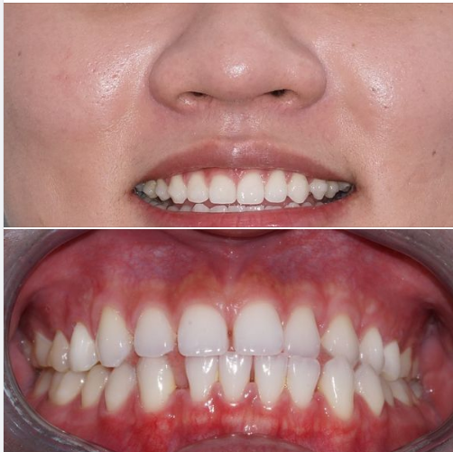 Hồi xưa mình cười không được như vậy đâu -   Mới có 9 tháng mà đã khác quá trời rồi!