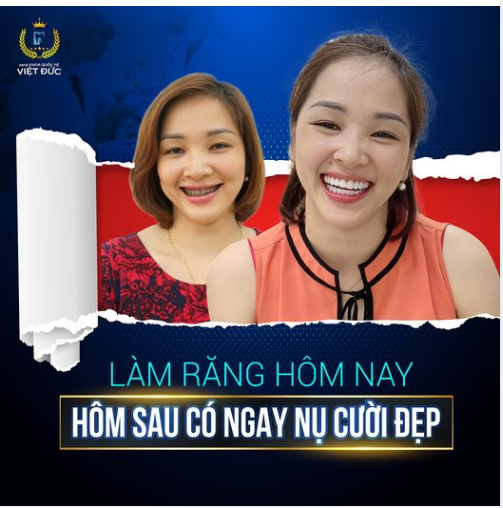 Hôm nay làm răng ngày mai có ngay nụ cười đẹp