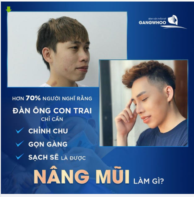 Hơn 70% người nghĩ rằng: "Đàn ông con trai chỉ cần chỉnh chu, gọn gàng, sạch sẽ là được, nâng mũi làm gì?"