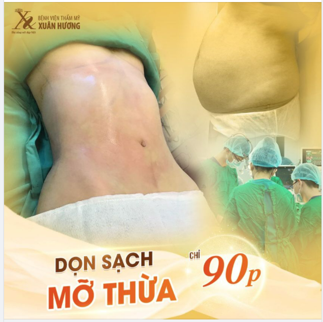 HÚT MỠ S-SHAPE BODY JET KHÔNG ĐAU - THON GỌN VÓC DÁNG