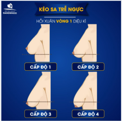 KÉO SA TRỄ NGỰC – PHƯƠNG PHÁP HỒI XUÂN VÒNG 1 DIỆU KÌ
