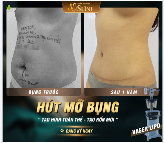 KẾT QUẢ HOÀN HẢO