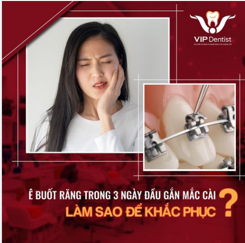 KHẮC PHỤC TÌNH TRẠNG Ê BUỐT RĂNG TRONG 3 NGÀY ĐẦU GẮN MẮC CÀI