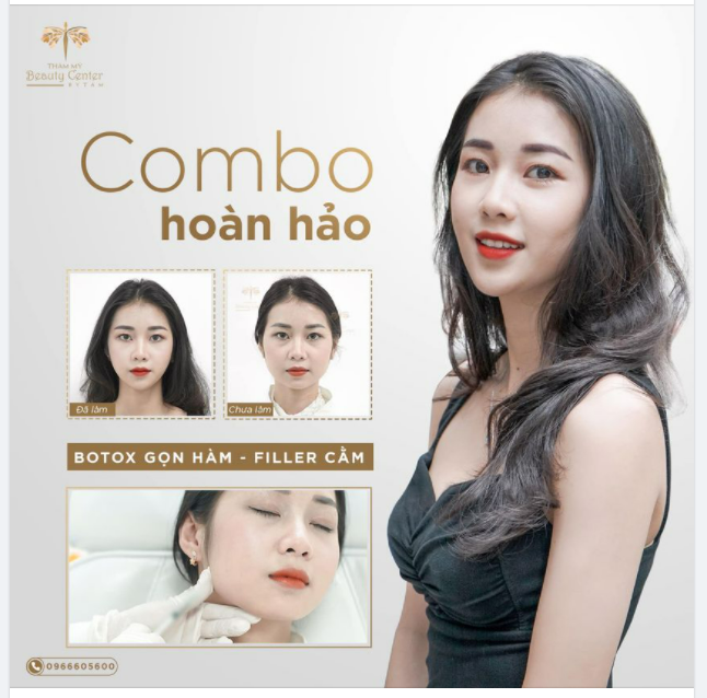 Khách hàng sử dụng dịch vụ Botox thon gọn hàm và Filler cằm được lột xác với hình ảnh tươi mới và thu hút hơn!