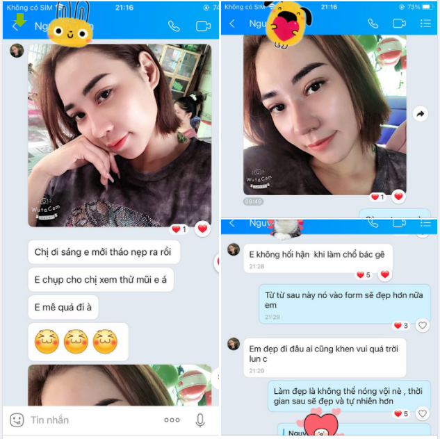 Khách làm ở BSK xong hay hối hận Hối hận sao không làm sớm hơn