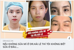 "Khi cắt mí bị biến chứng lỗi, hỏng nặng Người ta thì lo lắng, hoang mang, stress, tự ti.....Còn tôi thì đi thẳng đến Dr.Hải Lê"