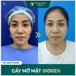 KHI ĐI MẶT GẦY MÁ HÓP - KHI VỀ PHÚNG PHÍNH TƯƠI XINH