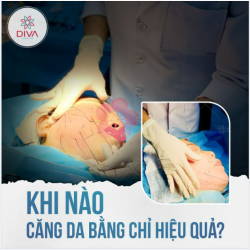KHI NÀO CĂNG CHỈ DA MẶT HIỆU QUẢ?