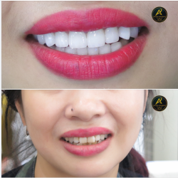 Khi xem bài viết này bạn sẽ thấy được 3 hình ảnh - Đó là hình ảnh của bạn nếu được như thế