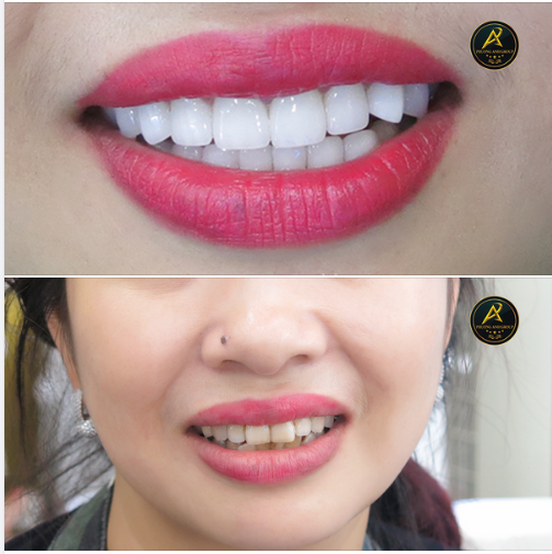 Khi xem bài viết này bạn sẽ thấy được 3 hình ảnh - Đó là hình ảnh của bạn nếu được như thế