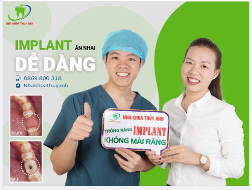 KHÔI PHỤC RĂNG MẤT, ĂN NHAI DỄ DÀNG HƠN VỚI RĂNG IMPLANT