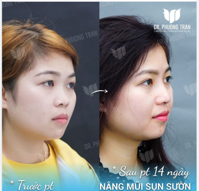 Không cần makeup em vẫn xinh nhất khu Chẳng cần ai nữa vì em đã đúng gout!