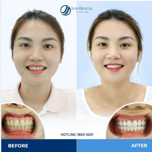 LÀ CON GÁI PHẢI XINH - CƯỜI LÀ PHẢI ĐẸP!