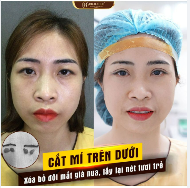 "Làm combo này auto trẻ ra vài tuổi và xinh thêm mấy chân kính"