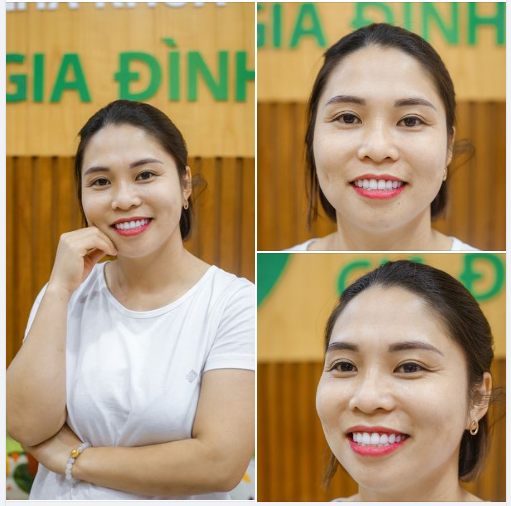LÀM ĐẸP RĂNG GIÁ SIÊU ƯU ĐÃI MỪNG NGÀY GIA ĐÌNH VIỆT