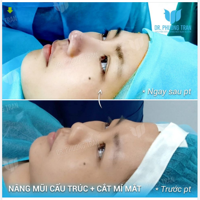 “LÀM LUÔN COMBO DỊCH VỤ CHO NÓ SỐC”