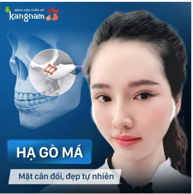Làm thế nào để gương mặt bớt thô với gò má cao?