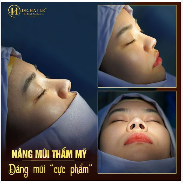 Làm xong khoe ngay, không ai nghĩ đây là dáng mũi vừa làm xong đúng không ạ!