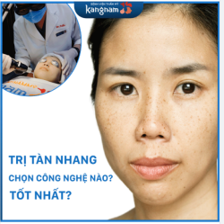 LASER PICOSURE - công nghệ trị tàn nhang số 1
