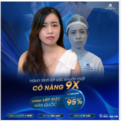 LẤY LẠI NỤ CƯỜI CHO NGƯỜI LIỆT MẶT