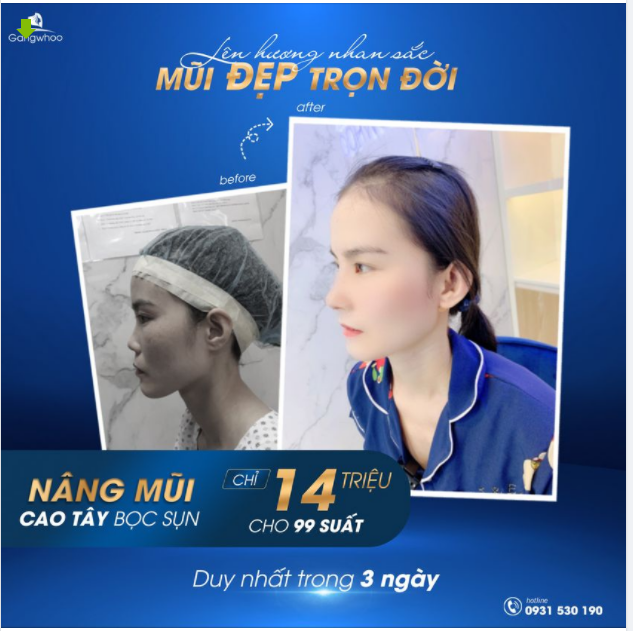 LÊN HƯƠNG NHAN SẮC - MŨI ĐẸP TRỌN ĐỜI