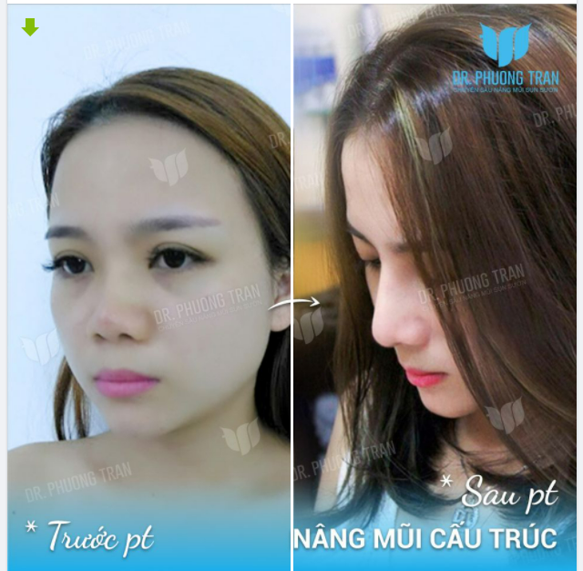 Lực hút của trái đất là 9,81m/s Còn lực hút của em đây là vô cực