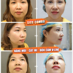 LÚC NÀY TÔI CHỈ MUỐN NGẮM NHỮNG SIÊU PHẨM COMBO "LỘT XÁC" HOÀN HẢO THÔI Ạ