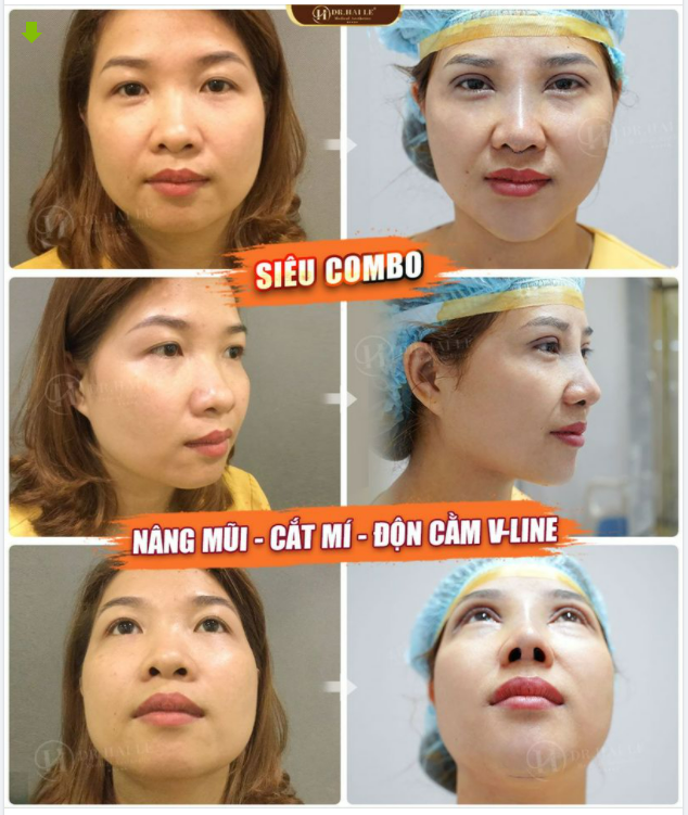 LÚC NÀY TÔI CHỈ MUỐN NGẮM NHỮNG SIÊU PHẨM COMBO "LỘT XÁC" HOÀN HẢO THÔI Ạ