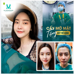 LƯU GIỮ THANH XUÂN CHỈ VỚI 1 LẦN CẤY MỠ MẶT